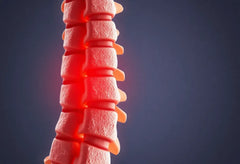Soulagement durable grâce à l'arthrodèse du dos : découvrez comment cette chirurgie transforme la vie