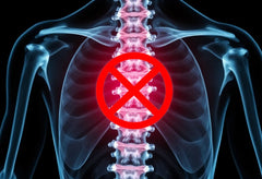 Pourquoi la radiographie ne suffit pas pour diagnostiquer une hernie discale