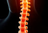 Comprendre et soulager la douleur d'une hernie discale L5-S1