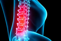 Soulagez votre hernie du dos avec des solutions ergonomiques innovantes