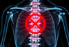 Pourquoi la radiographie ne suffit pas pour diagnostiquer une hernie discale