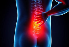 Comprendre la sciatique : causes, symptômes et solutions pour un soulagement efficace