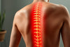 Soulager la douleur d'une hernie discale : des solutions qui fonctionnent vraiment