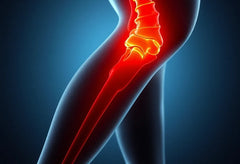 Éliminez la douleur à la fesse avec des solutions simples et efficaces